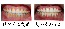 ֣Ψ永