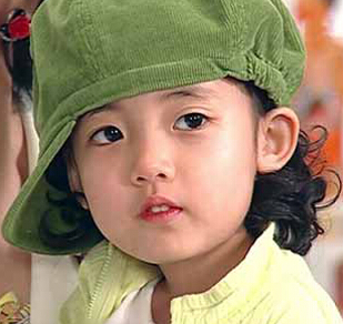 儿童的畸形牙如何矫正 儿童的畸形牙如何矫正