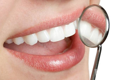 重度四环素牙的治疗方法