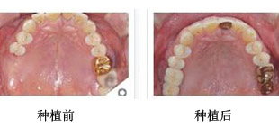 种牙那家技术比较好